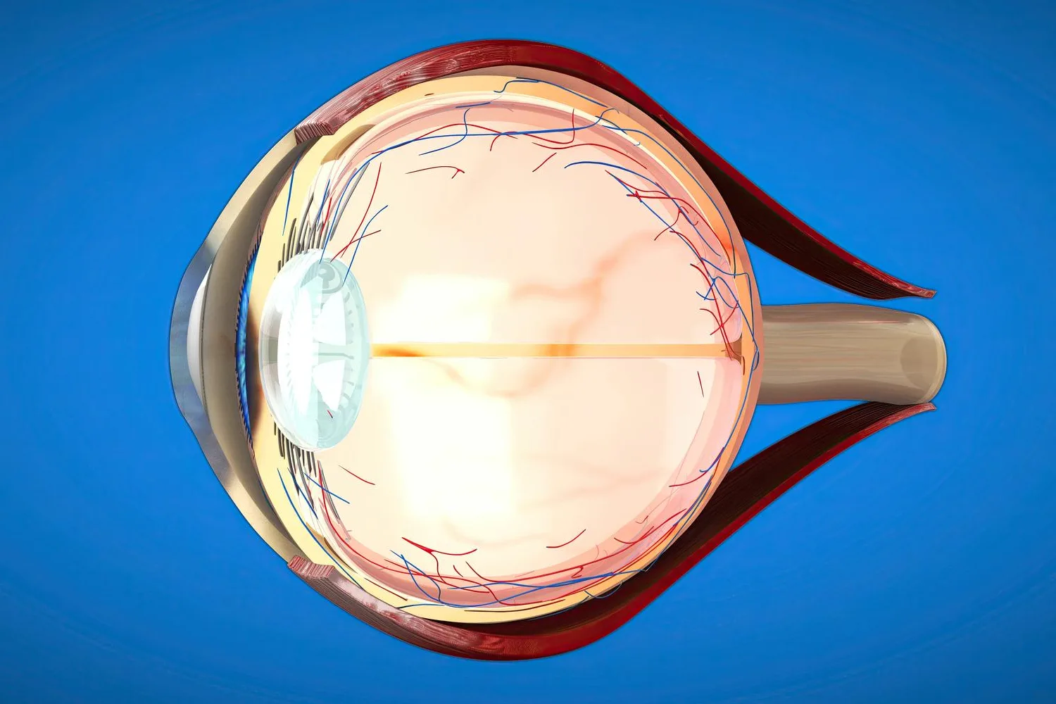 Cirugía de desprendimiento de retina
