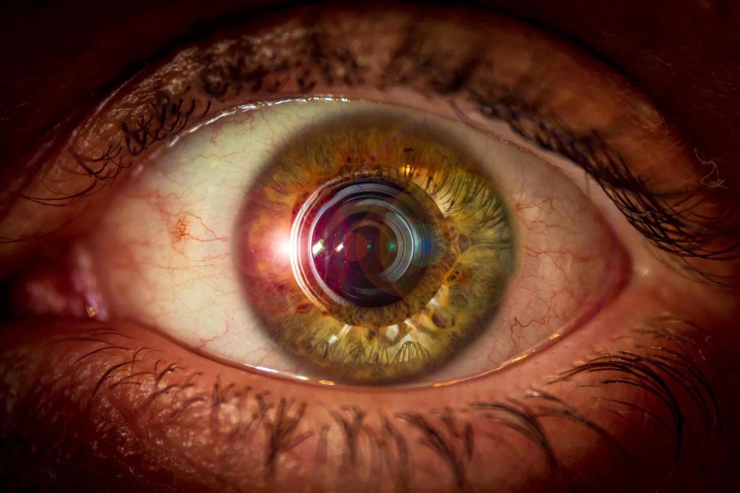 Clínica de retinopatía diabética